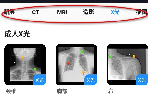 Ӱ�����ͼ��(ҽѧӰ��ѧϰƽ̨)