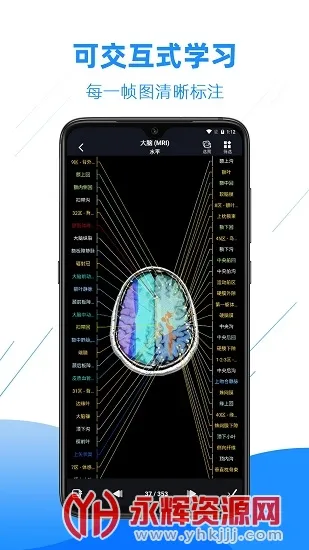 Ӱ�����ͼ��(ҽѧӰ��ѧϰƽ̨)v4.6.2 ��׿���ͼ