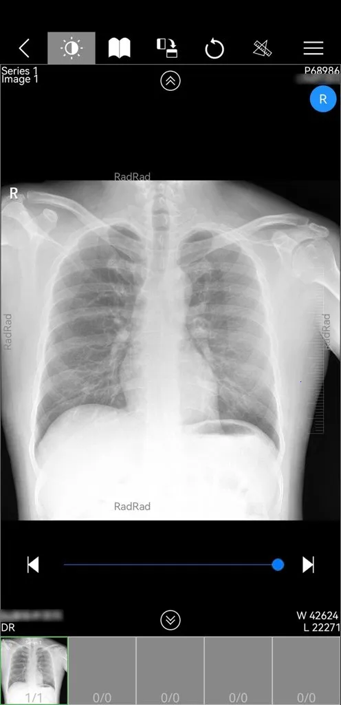 ΢Ӱҽ��(ҽ��Ӱ�����)v1.18.101 �ֻ����ͼ